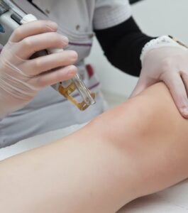 Read more about the article Stay Beautiful After Laser Hair Removal: 5 Post Treatment Tips To Follow