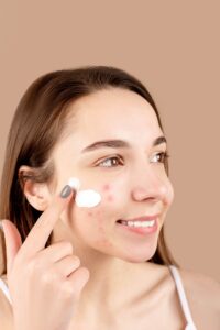 Read more about the article Can you get rid of acne and its scars? Find out here